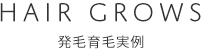 発毛育毛事例